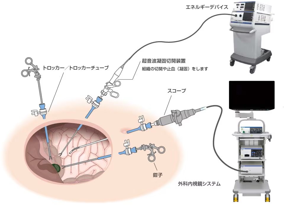 Olympus Corporation endoscope medical device / facility